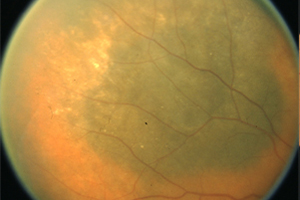 Fotodokumentation – Augenärztliche Gemeinschaftspraxis | Dr. Heuring, Dr. Jung & Kollegen