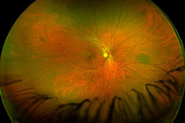 Netzhautuntersuchung – Augenärztliche Gemeinschaftspraxis | Dr. Heuring, Dr. Jung & Kollegen