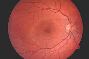 Augenhintergrund – Augenärztliche Gemeinschaftspraxis | Dr. Heuring, Dr. Jung & Kollegen